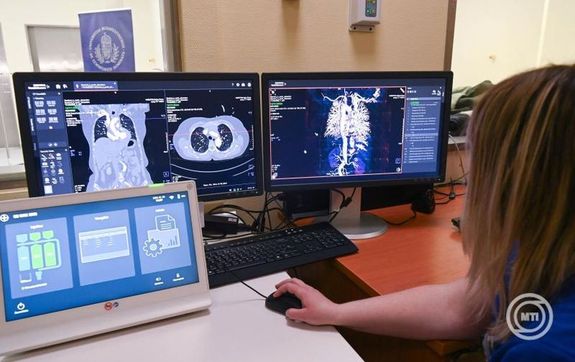  Monitorok a srgssgi elltsra szorul betegek gyorsabb s pontosabb diagnzist segt, msodik jgenercis foronszmll CT-kszlk bemutatjn, az tadnnepsg napjn, a Semmelsweis Egyetem Kzponti Betegellt pletben, 2025. janur 9-n. Kp: MTI / Bruzk Nomi