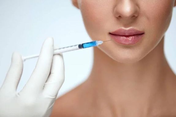 A b�k�scsabai n� lak�h�z�ban kozmetik�t m�k�dtetett, ahol hialuronsavas ajakfelt�lt�st v�gzett anyagi ellenszolg�ltat�s�rt, jogosulatlanul. A k�p illusztr�ci�. K�p: DepositPhotos   